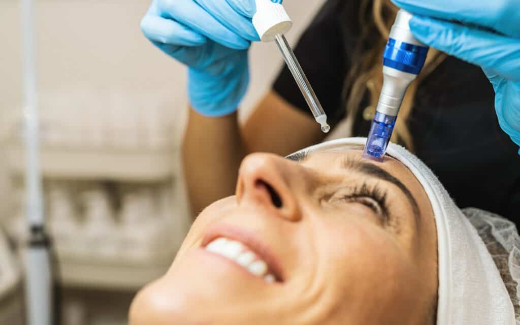 A close-up of a person receiving a facial microneedling treatment, with a dropper applying serum and a technician using a dermapen device on the forehead.
