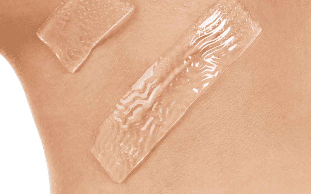 Two transparent adhesive medical patches are applied to a section of bare skin, with light reflecting off their textured surfaces.